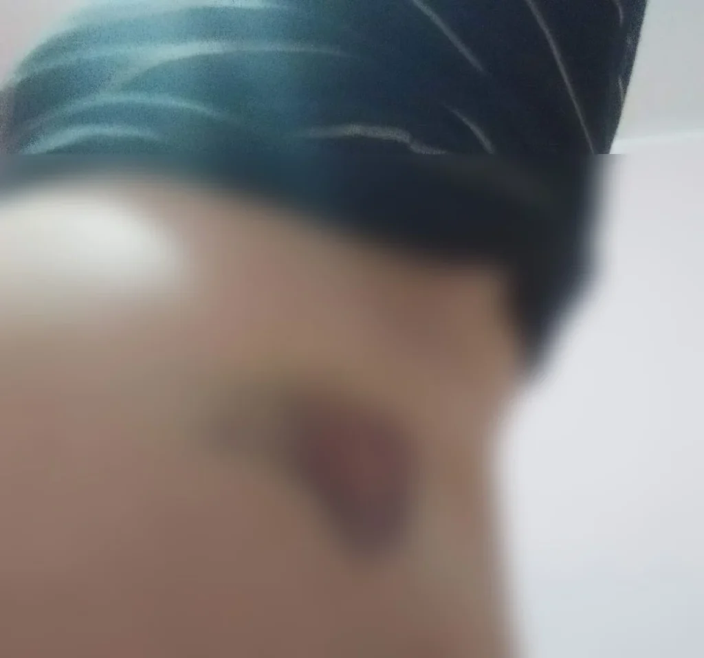 بسبب عجزه جنسياً.. شاهد ما فعله رجل أعمال مصري شهير بجسد عروسته الجزائرية في ليلة دخلتهم