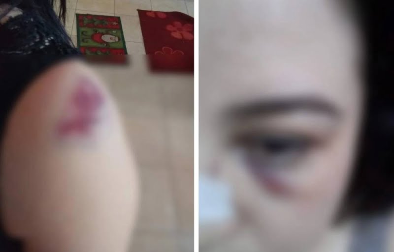 القصة الكاملة تحكيها فنانة جزائرية شهيرة عن زوجها رجل الأعمال المصري الشهير الذي لم يستطع فض بكارتها حتى الان