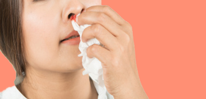 للحوامل: في حالة نزول دم من الأنف فهذا ما يجب فعله فوراً