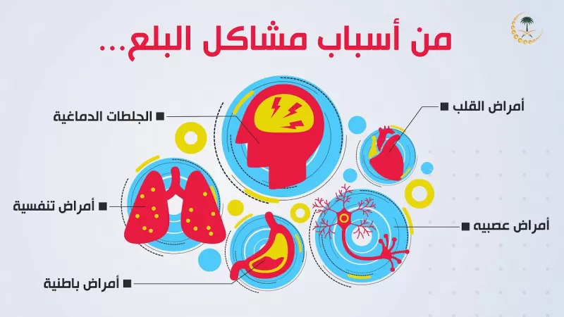 أسباب وعلاجات.. صعوبة البلع يجب عدم التهاون بها