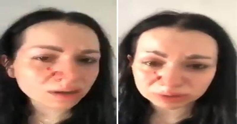 شاهد: زوجة رئيس رابطة الصحافيين السوريين في تركيا تفضحه بعد الاعتداء عليها وهي حامل