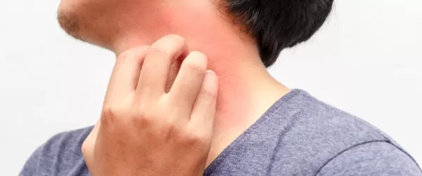 الحكة الشديدة في هذه المناطق الحساسة في فصل الشتاء سببها شيء لا يصدق