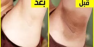 تعرف عليها : هذه أقوى خلطات تفتيح الأماكن الحساسة للعروسة قبل الزفاف تبيض فوري وسريع