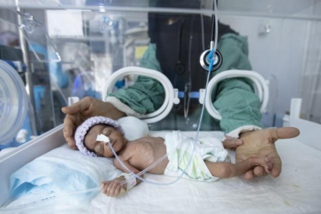 ”الأمم المتحدة” تعتزم إغلاق عشرات البرامج الاغاثية والصحية ومشاريع الأشغال العامة في اليمن خلال الأيام القادمة