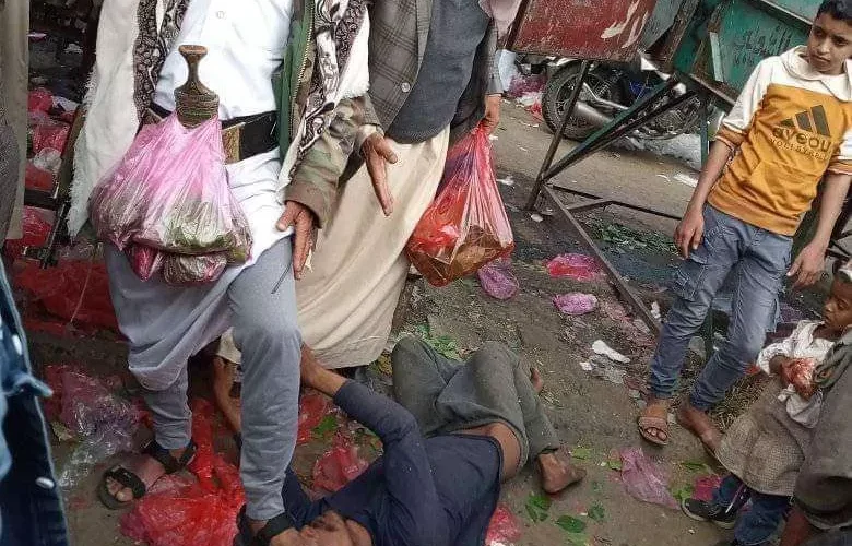 الكشف عن هوية المواطن الذي تعرض للدهس باقدام البرادعي بإب ويروي تفاصيل ماتعرض له