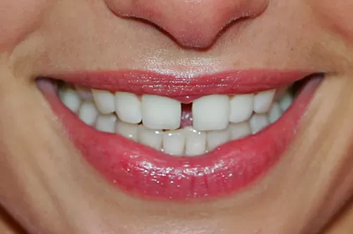 هذا ما تفعله نصف ليمونه عند فركها بهذا الجزء من الجسم والذي سيغير شكلك تماماً خلال دقائق