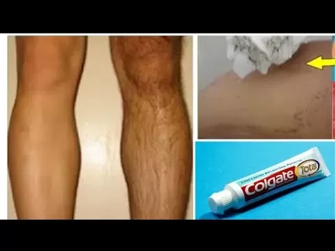 سر  وصفة معجون الأسنان لأزاله شعر العانة و شعر الجسم كله بدون الم والشعر سوف يسقط ولن يعود نهائيا
