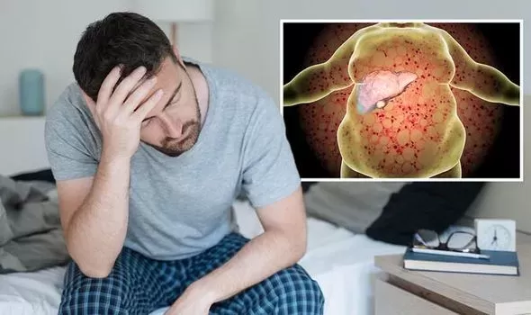علامات تظهر عليك في الصباح تؤكد اصابتك بالكبد الدهني