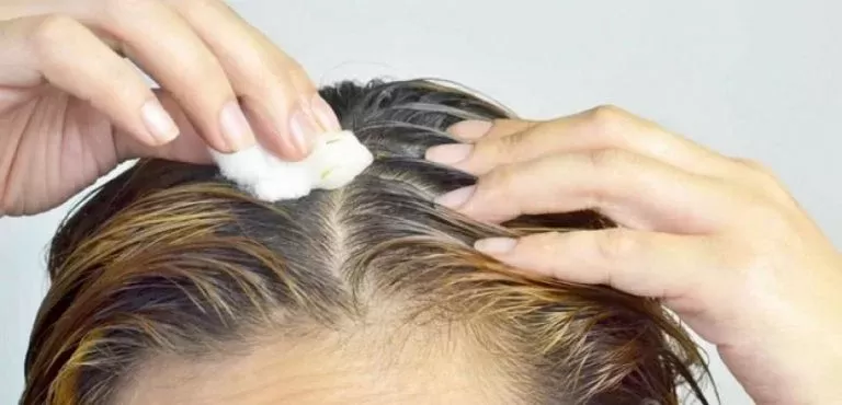 تحذير من تجاهل الم فروة الرأس لانه عرض لمرض خطير يجب الكشف عنه مبكراً.