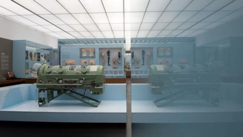 ”معجزة طبية”.. رجل يعيش أكثر من 70 عاما داخل ”رئة حديدية” بعد إصابته بمرض قاتل