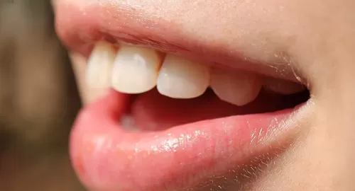 طريقة بسيطة وفعالة لتبييض الأسنان في المنزل مهما كانت حالتها