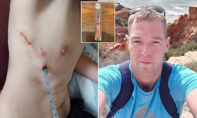 شاهد: شاب سعودي لم يكمل الثلاثين عاماً تناول السجائر الالكترونية لمدة شهر واحد فقط وهذا ما فعلته به