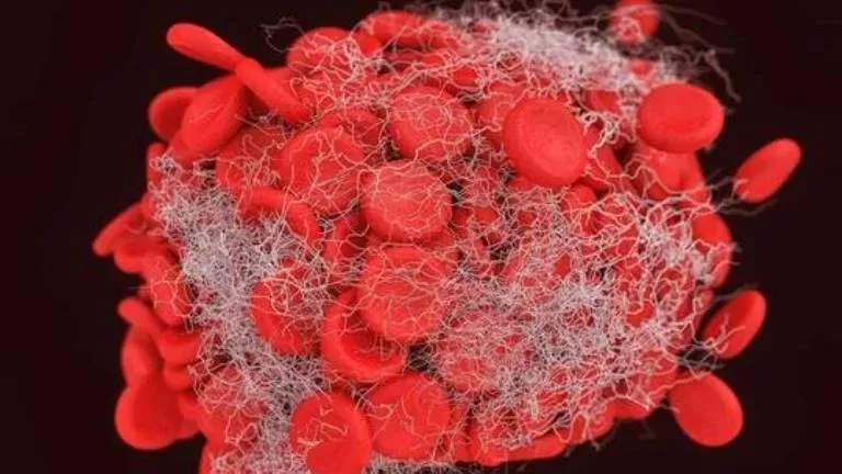 دراسة صادمة تكشف عن تسبب نقص شرب الماء في الاصابة بهذا المرض القاتل.