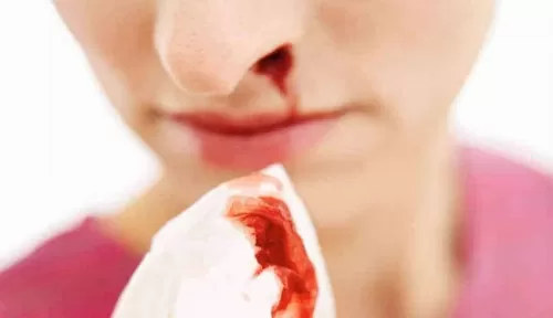 ما هي الأمراض الخطيرة التي يكون الرعاف احد اعراضها ؟