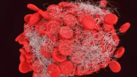 دراســة صادمة تكشف عن تسبب نقص شرب الماء في الاصابة بهذا المرض القاتل