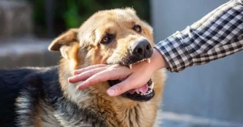 7 أشياء عليك القيام بها إذا تعرضت لعضة كلب
