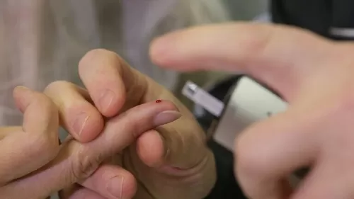 هذه هي العلامات التي تظهر على اليدين حال ارتفاع مستويات السكري