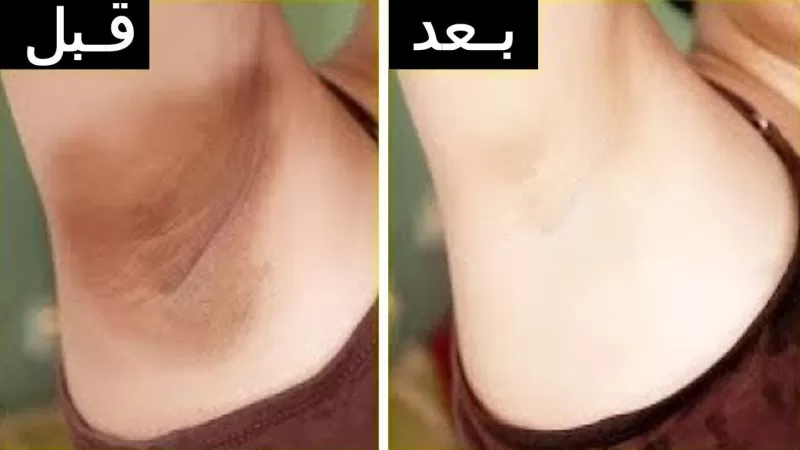 خـــــاص للنســــاء : وصفة سريعة ورخيصة الثمن وطبيعية لتفتيح المنطقة الحساسة وتحويلها للون الوردي الفاتح !