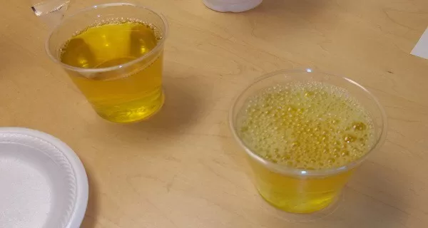 قبل فوات الاوان.. اذا وجدت رغوه في البول احذر فورا فهذا يدل علي مؤشر لمرض خطير جدا !!