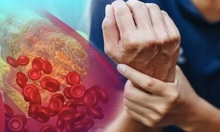 اشهر الاعراض التي تدل بوضوح على ارتفاع نسبة الكوليسترول الضار في الجسم