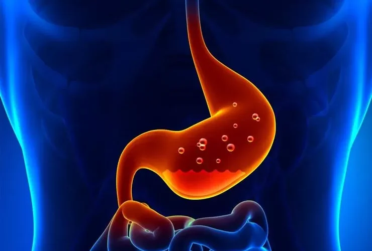 طرق علاج جرثومة المعدة بدون ادوية وبوصفة بسيطة من الاعشاب الموجودة في كل مكان