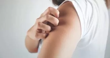 طرق فعالة للتخفيف من مشاكل الصدفية