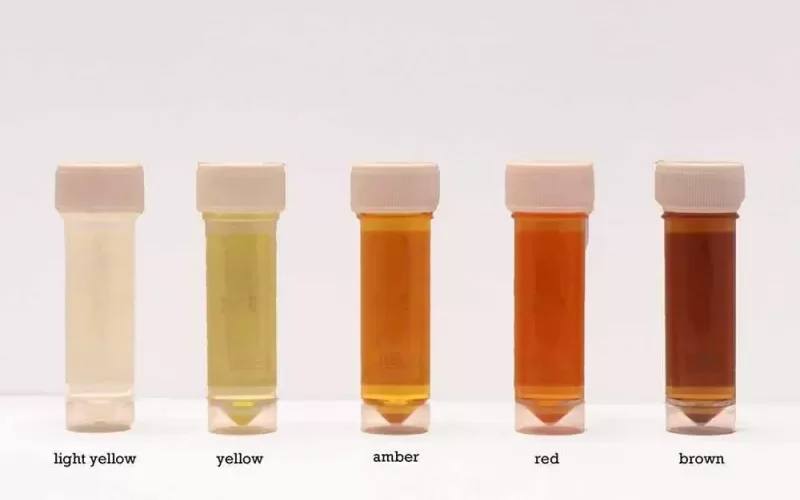 هذه الوان البول التي تدر على اصابتك بامراض خطيرة