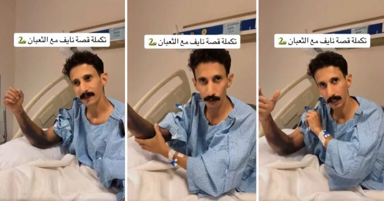 شاهد هاوي صيد ثعابين سعودي يكشف عن ما حدث لذراعه بعدما لدغه ثعبان سام فجأة