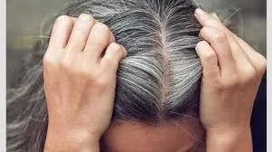 التخلص من الشيب نهائياً بملعقة واحدة من القرنفل وودعي الشعر الأبيض إلى الأبد