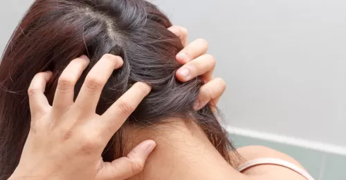 اسباب لا تتوقعها تسبب الصلع وتساقط الشعر وهذه طرق العلاج السهلة من المنزل