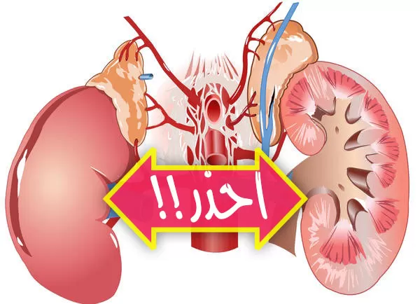 عشر عادات يومية خطيرة مسؤولة عن تدمير كليتك