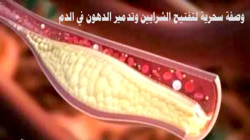 مشروب تنظيف وعلاج الشرايين المسدودة ستخرج من شرايينك دهون ملتصقة لم تخرج من سنوات وسينتعش قلبك