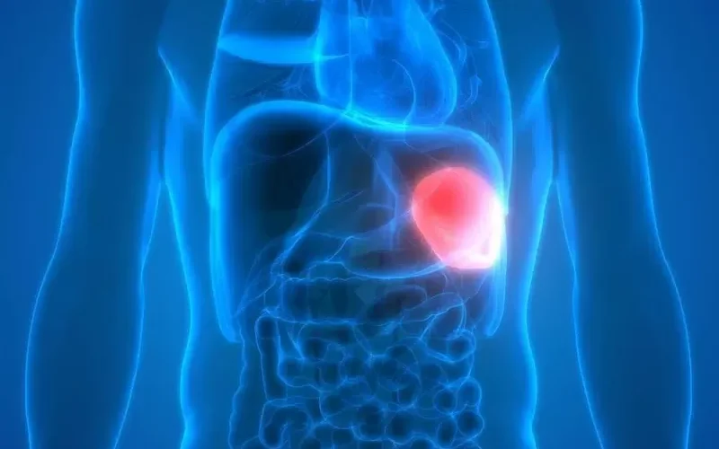 لهذه الأسباب يجب عليك عدم تجاهل تضخم الطحال