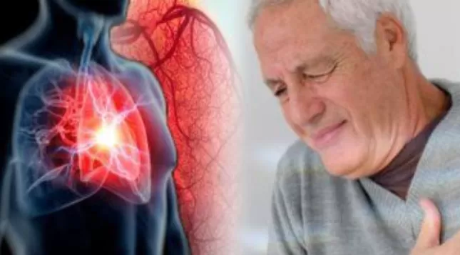 هذا هو سبب الموت المفاجئ للرجال اثناء ابو بعد العلاقة الحميمة