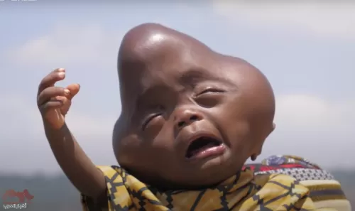 فيديو صادم لوالد يحاول قتل ابنه بسبب شكله الغريب ويصفه بأنه ابن الشيطان