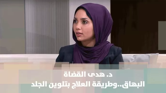 اخصائية سعودية تكشف سبب غريب جداً لانتشار البهاق بين المراهقين في السعودية
