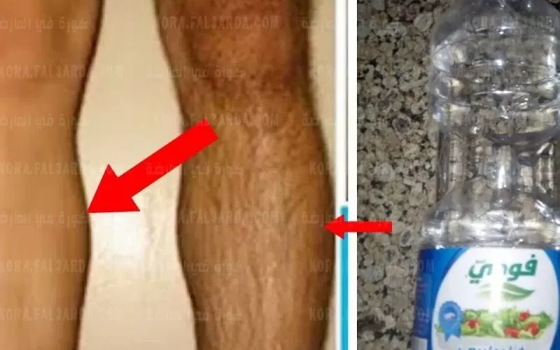 معجزة الخل للتخلص من شعر العانة بدون الم ولن يعود للنمو مرة اخرى