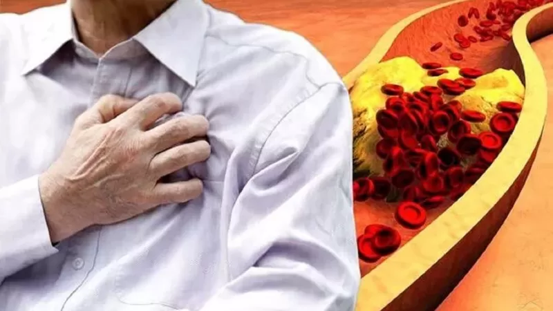 تعرف عـلى أعراض ارتفاع الكوليسترول الضار.. واحترسوا من هذه العلامة الخطيرة !!