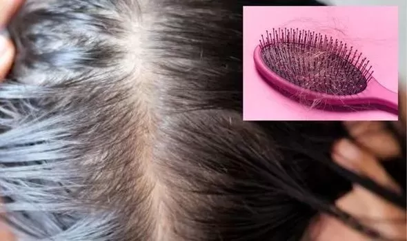 سبع خرافات عن تساقط الشعر احذر ان تصدقها