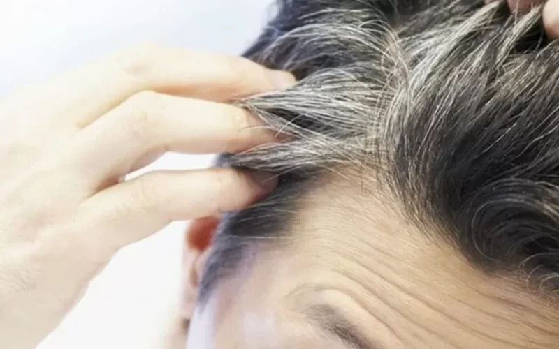 نقص هذه الفيتامينات هو السبب الرئيسي لظهور الشيب والشعر الأبيض واطعمة رخيصة الثمن تعوض نقصها وتمنحك شعر لا شيب