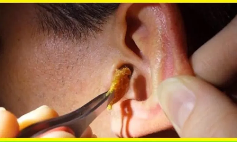 طريقة سحرية لإخراج الشمـع من الأذن والاوساخ بكل سهوله فى دقيقه واحده وبـدون ألـم !!