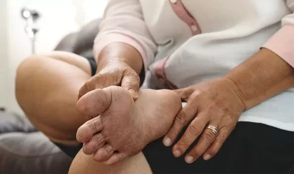 بينها ظهور  بقع تسبب الحكة.. 6 علامات في الجلد تشير الى اصابتك بداء السكري من نوع 2