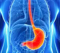 التهاب المعدة اعراضه واسبابه وطرق علاجه