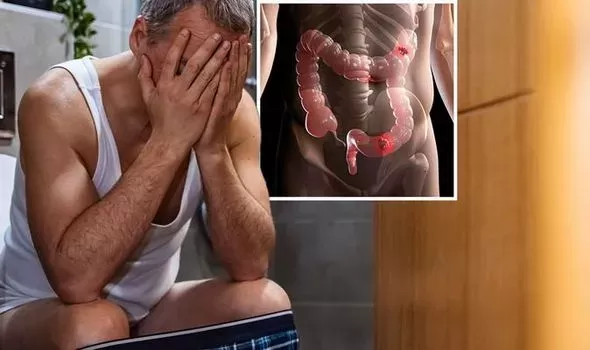 اعراض عند التغوط تدل على الاصابة بسرطان الامعاء يجب عدم تجاهلها في مرحلة مبكرة