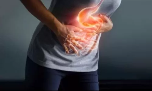 علاجات منزلية فعالة لحموضة المعدة