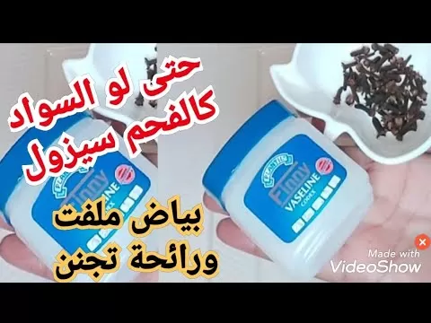 شاهد المعجزة التي ستحدث عند دهن هذه المناطق في جسمك بخلطة القرنفل والفازلين