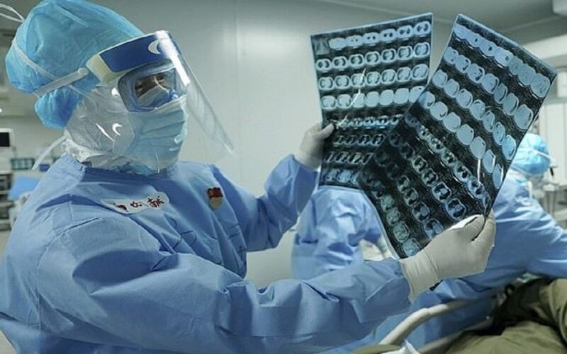 لماذا يستوطن كورونا الرجال أكثر من النساء؟.. الكشف عن السر العجيب