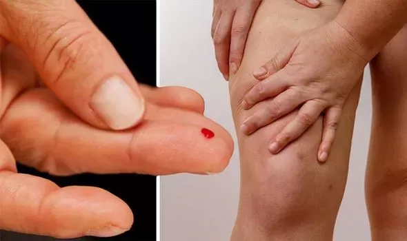 علامة التحذير “الأقل ظهوراً ” لتلف سكر الدم المتقدم في أسفل الساقين!