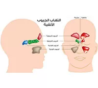 اعـــراض لا تتوقعها تسببها التهاب الجيوب الانفية وهذه طرق علاجها الطبيعية !