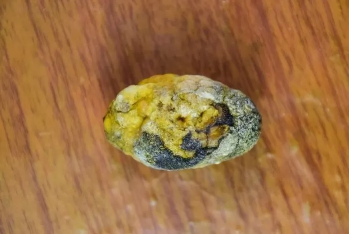 مشروب شعبي رخيص الثمن ينظف الكلى ويفتت الحصوات ويخرجها مع البول.. تعرف عليه